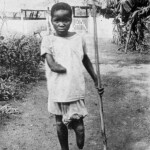 Bambina congolese amputata per punizione