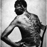 Uno schiavo del Mississippi mostra le sue cicatrici, 1863